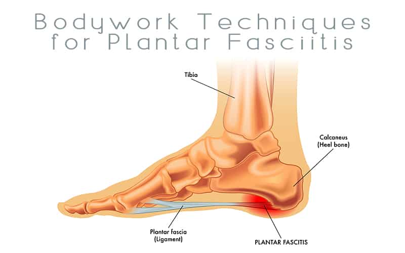 Illustration of foot showing the bones inside with area of plantar fasciitis highlighted in red