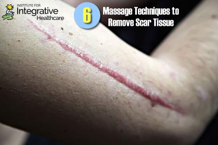 Six Massage Techniques to Remove Scar Tissue