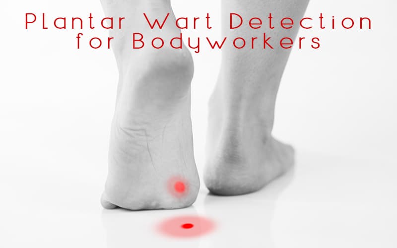 Back side of a pair of feet walking whereby the left foot has a red dot indicating location of plantar wart