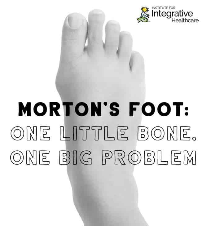 Morton's Foot: One Little Bone, One Big Problem