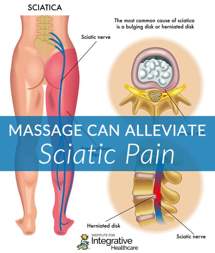 How Massage Can Ease Sciatic Pain