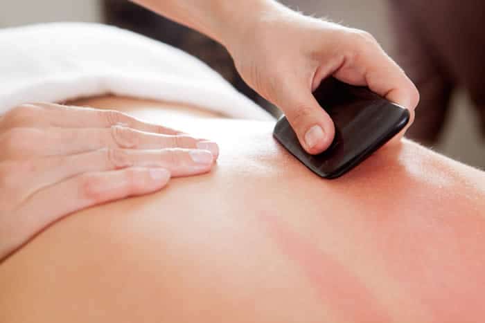 Gua Sha can cause discoloration of the skin, appearing as shades of pink, red or purple.