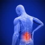 The Relationship Between Low Back Pain and Sciatica