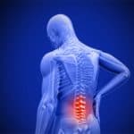 Essential oils for sciatica and lower back pain – Absolute Essential