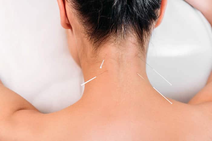 Will more massage therapists also become acupuncturists in the next 5 years?