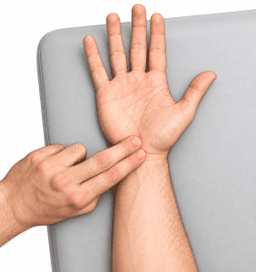 Tinel's test assessing the median nerve at the wrist for carpal tunnel syndrome